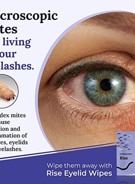 Cornea Care Rise - Eyelid Wipes  w/ Tea Tree Oil & Hyaluroni