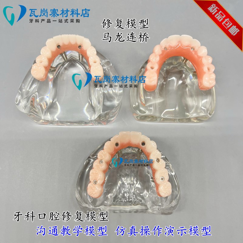 牙科口腔b模型马龙连桥义齿修复种植牙齿仿真演示模拟教学医患沟