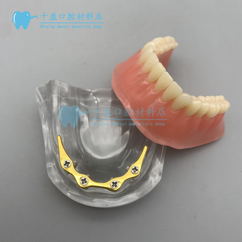 牙科口腔模型银杆卡修复模型半口种植修复模型金杆卡种植教学模型