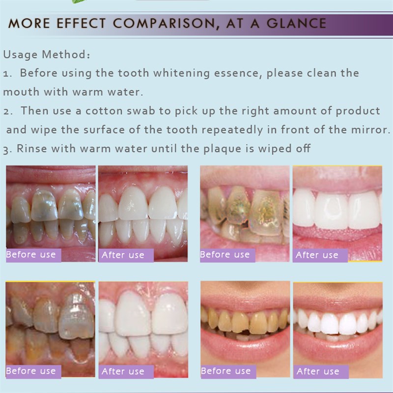 Teeth Oral Hygiene Whitening Daily Use Effective Remove Plaq