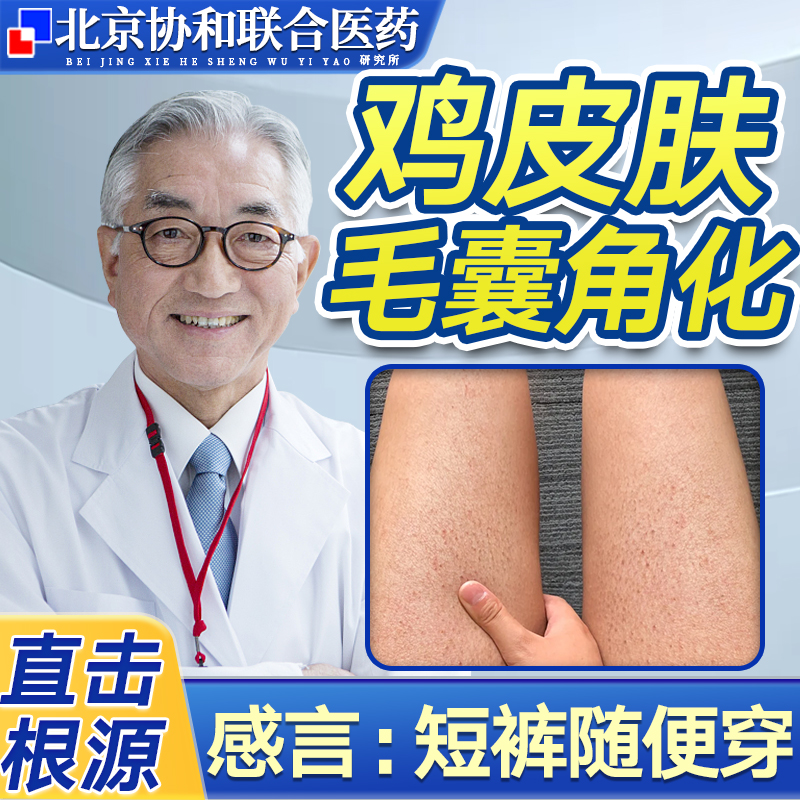 毛周角化症大腿手臂鸡皮肤疙瘩毛囊炎角化去除神器可搭药膏hy