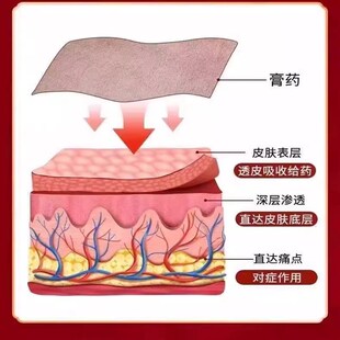 精选肩周贴膏肩膀肿胀僵硬麻木肩颈劳损抬臂困难肌腱拉伤专用贴膏