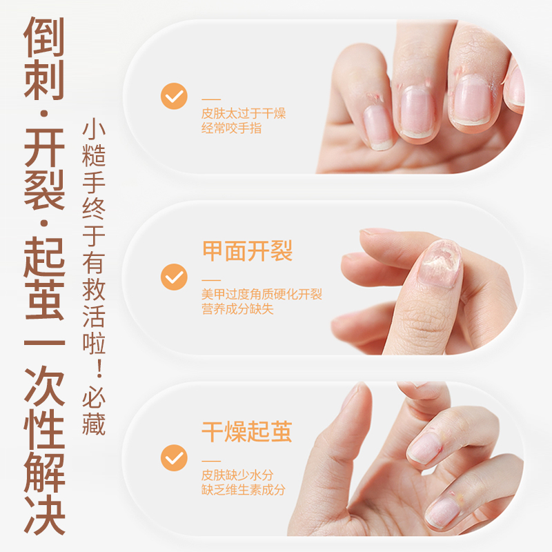 指甲修复液受损再生手指甲边缘营养油倒刺死皮护理断肉刺根软化剂