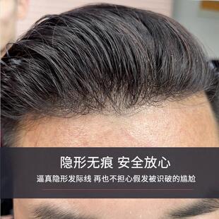 假发男男头顶补发全手织发然飞机头OYE帅气真自遮地中海秃头士补