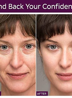 Novapholia Forehead Wrinkle Patches  Set of 192 Pcs Face Wri