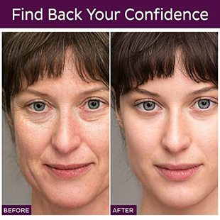 Novapholia Forehead Wrinkle Patches Set of 192 Pcs Face Wri