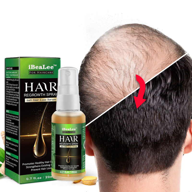 Ginger Hair Growth Hair Essential Oil Prevent Hair Loss Oil