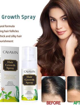 Hair Growth Spray 天然头发喷雾Rosemary Oil Hair Care Spr