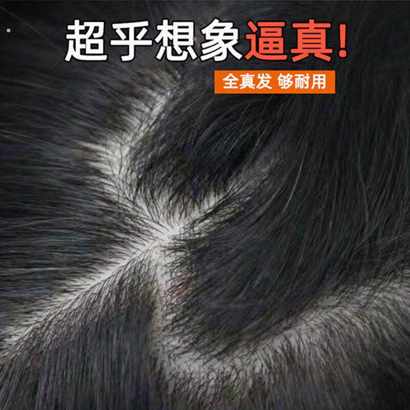 假发男士双递针头顶补发片自然发际线无痕隐形全真发秃顶补发块