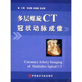 【正版包邮】 多层螺旋CT冠状动脉成像 毛定飚张国桢滑炎卿 科学技术文献出版社