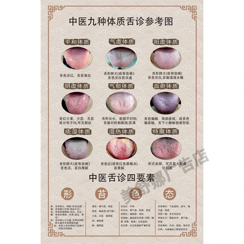 中医体质辨识舌诊挂图养生店九种体质对应舌诊症状装饰画自粘海报