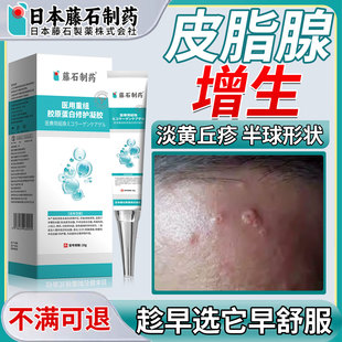 面部皮脂腺增生鼻子囊肿异位症瘤脸上肉粒疙瘩去除神器凝胶软膏FT