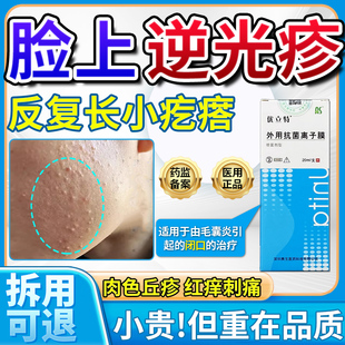脸上起小疙瘩逆光疹修复软膏额头小颗粒毛囊堵塞闭口粉刺激素脸OM