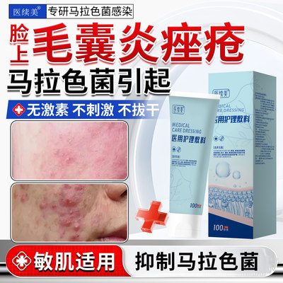 痤疮脸上起痘痘马拉色菌毛囊炎脓包型长红肿小硬疙瘩专用洗面奶OM