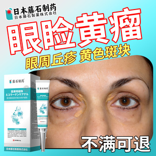 眼睑黄瘤软膏去眼周黄斑特眼部增生疙瘩效汗管祛眼皮眼角脂肪粒EH