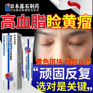 藤石高血脂眼睑黄瘤去除睑黄疣膏神器去眼皮黄斑疣专用药房同售OM