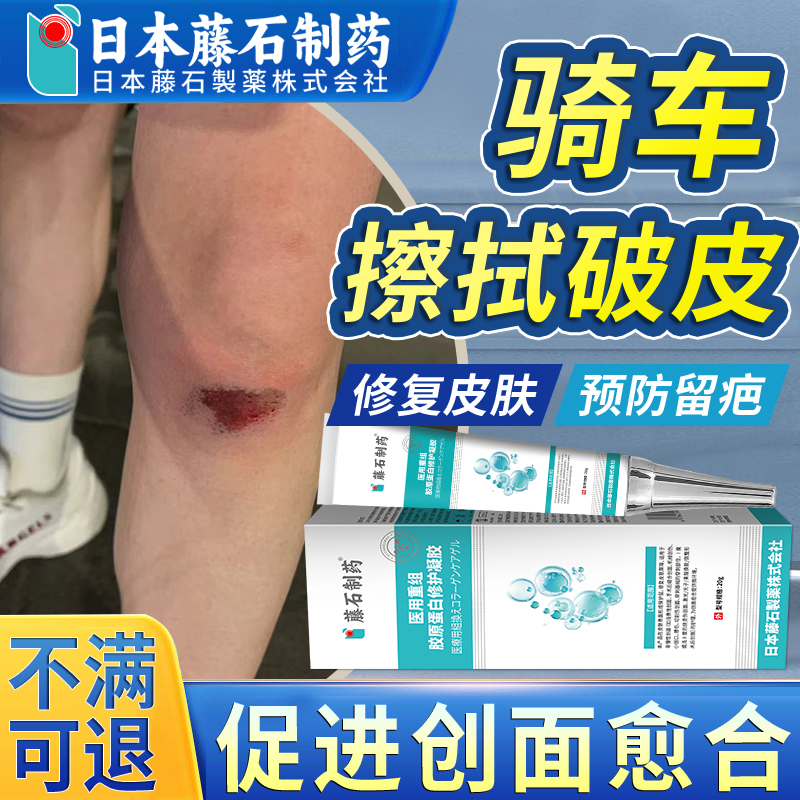骑车摔伤破皮儿童擦伤碰伤口快速愈合疤痕修复膏祛疤膏药监备案OM