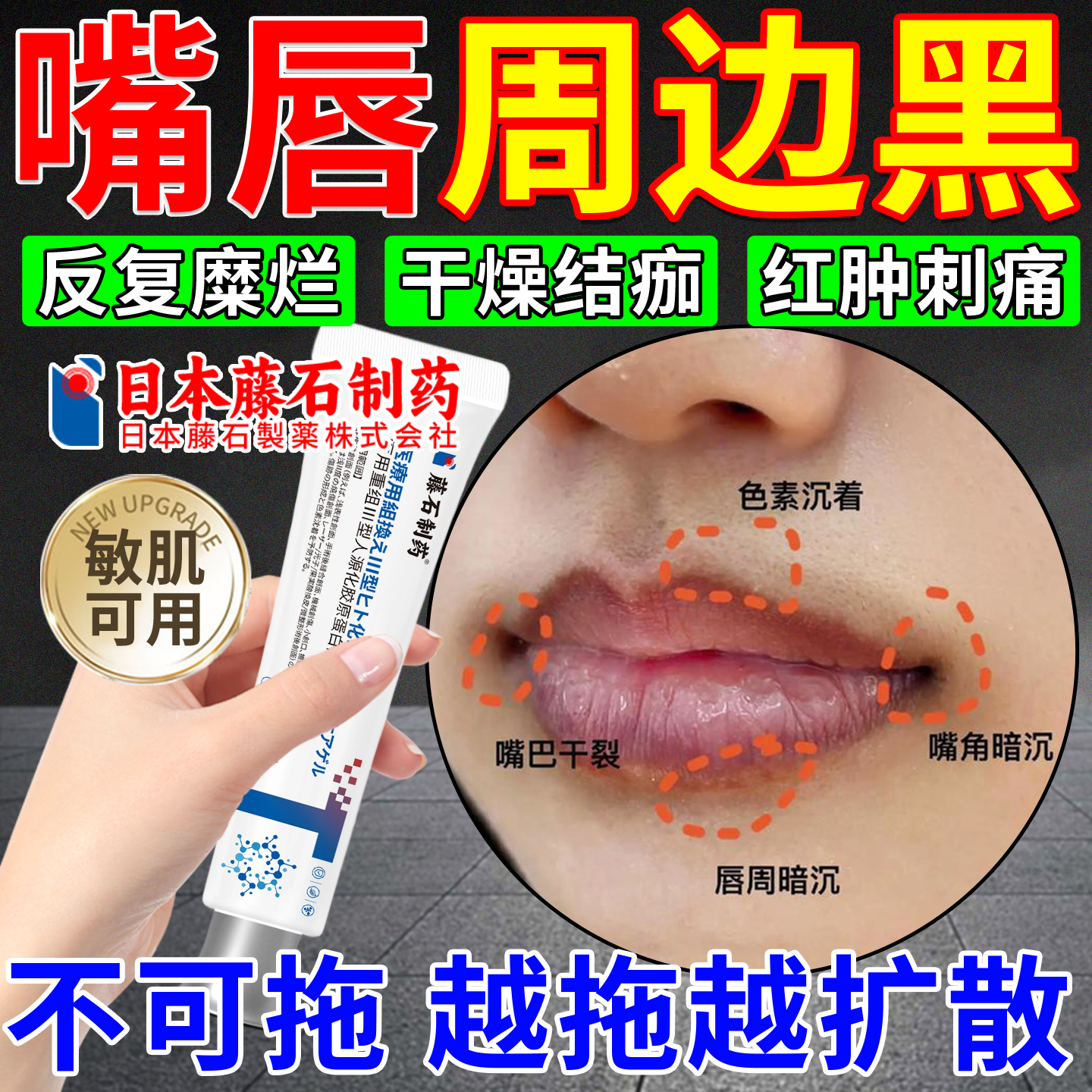 嘴唇周发黑色素沉淀去嘴角除唇炎色素沉着重组三型人源胶原蛋白OM