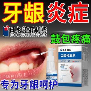 牙龈脓包肿痛消炎专用根尖周炎牙根尖炎牙龈发脓包鼓包正品保障OM