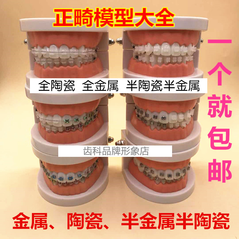 牙科口腔正畸托槽教学练习模型全金属托槽矫正医患沟通牙模型包邮
