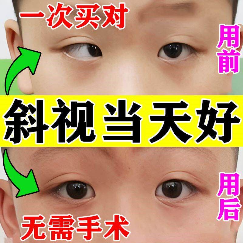 速发斜视矫正训练器聚散球视力纠正眼睛内外斜弱视斗鸡眼儿童眼药