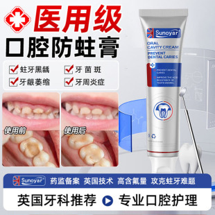 Sunoyar医用口腔护理黑斑黑线黑渍牙窝沟清洁蛀牙菌斑牙缝发黑2