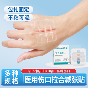 减张贴医用术后儿童面部伤口小号皮肤减张器创口绷带