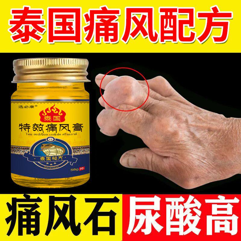 现货速发【泰国秘方】膏大脚趾肿胀手指关节疼痛石结晶尿酸高