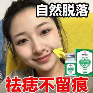tyk香港大药房点痣膏去痣肉刺脂肪植物萃取黑痣痦子瘊子点斑膏