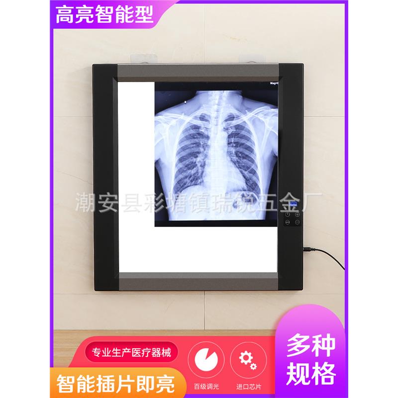 观片灯超薄led可调光读片灯箱双联X光胶片看片灯阅片灯箱单联片灯