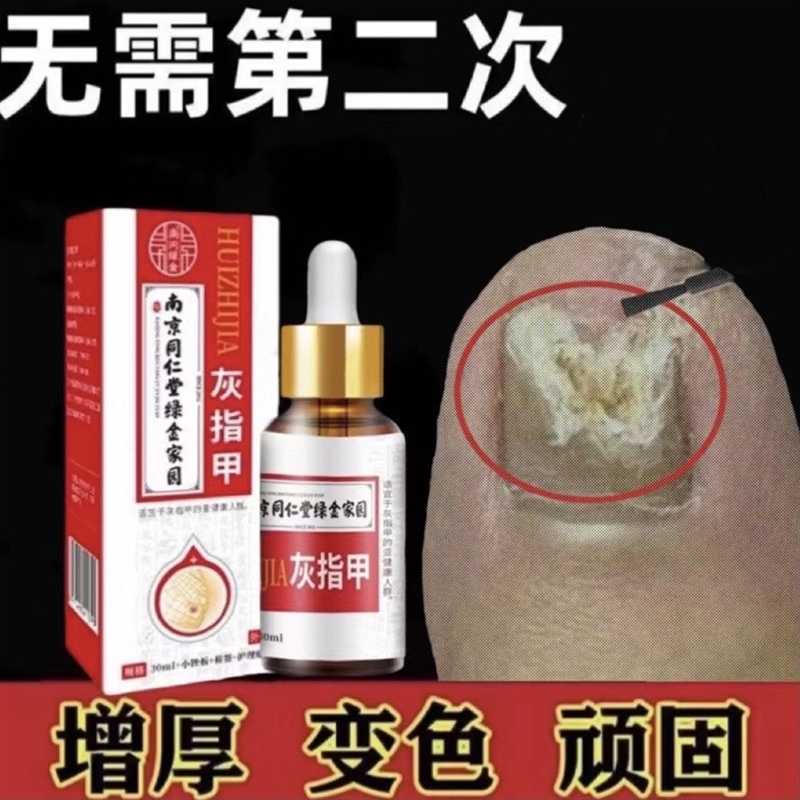 南京同仁堂灰指甲抑菌液绿金家园草本灰趾指甲亮甲风仙花修护增厚图片