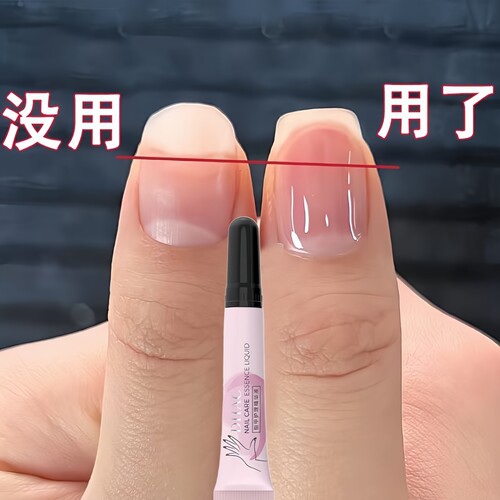 指甲营养液快速修复空心甲护甲改善甲床竖纹防断增厚非手工穿戴甲