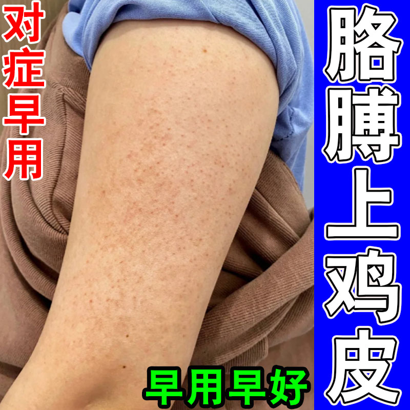 胳膊鸡皮肤疙瘩毛囊毛周角化去除皮肤消毒护理（消）