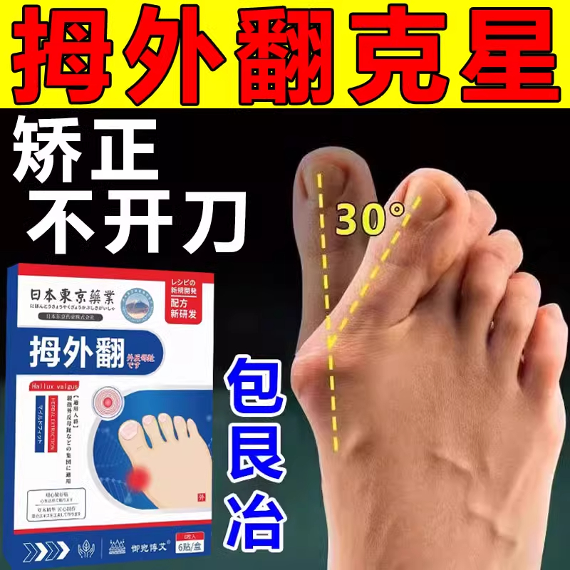 【已冶愈90万人】拇指外翻药膏贴大脚骨专用药脚趾重叠大拇指克星