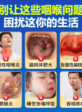 药康仁咽扁穴位磁疗贴改善急慢性咽炎咽喉炎扁桃体发炎腺样体JH12