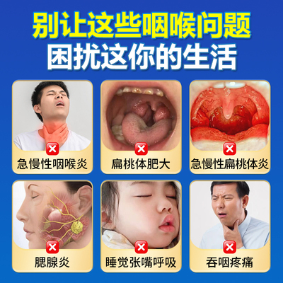 药康仁咽扁穴位磁疗贴改善急慢性咽炎咽喉炎扁桃体发炎腺样体JH12