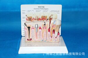 桌上型人体牙齿教学模型带说明板