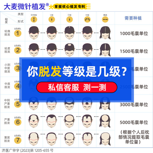 【大麦微针植发】发际线种植 适用脱发掉发稀疏植发【全国连锁】