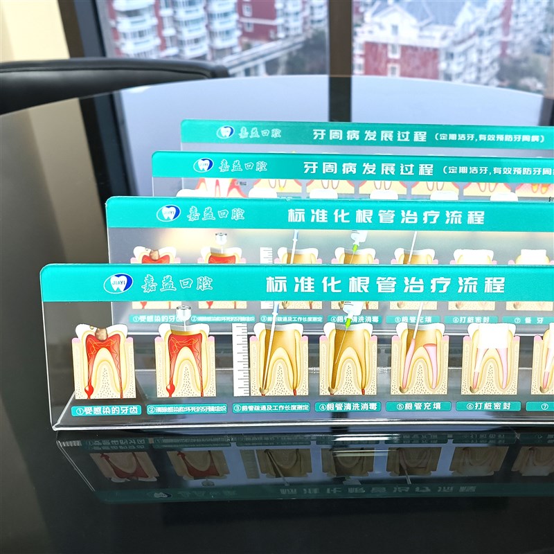 根管治疗定制模型办公医患沟通标识牙周种L植牙牙科沟通工具模型