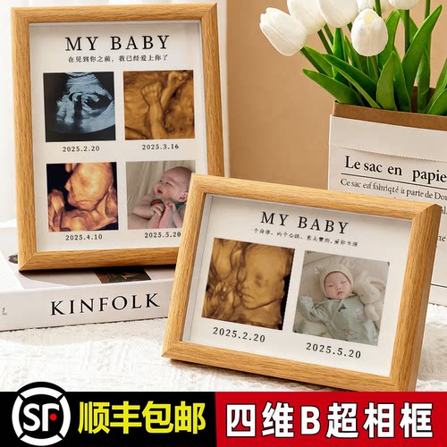 宝宝B超四维ai照片纪念相框彩超还原孕期产检婴儿出生小礼物摆件