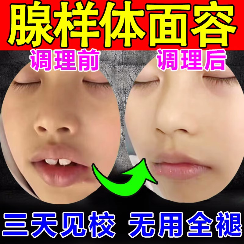 现货速发腺样体肥大面容矫正器儿童张嘴呼吸睡觉打呼噜嘴唇上翘调
