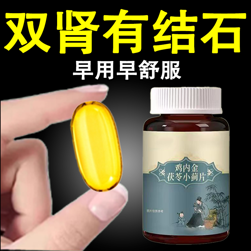 体内结石多正品鸡内金菊苣片结石堵塞用尿石胆石中材提取