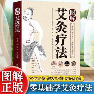 图解艾灸疗法中医适宜技术操作入门中医启蒙自学穴位艾灸养生零基础入门临床艾草艾灸疗法治疗常见病祛消百病临床针灸按摩医师参考