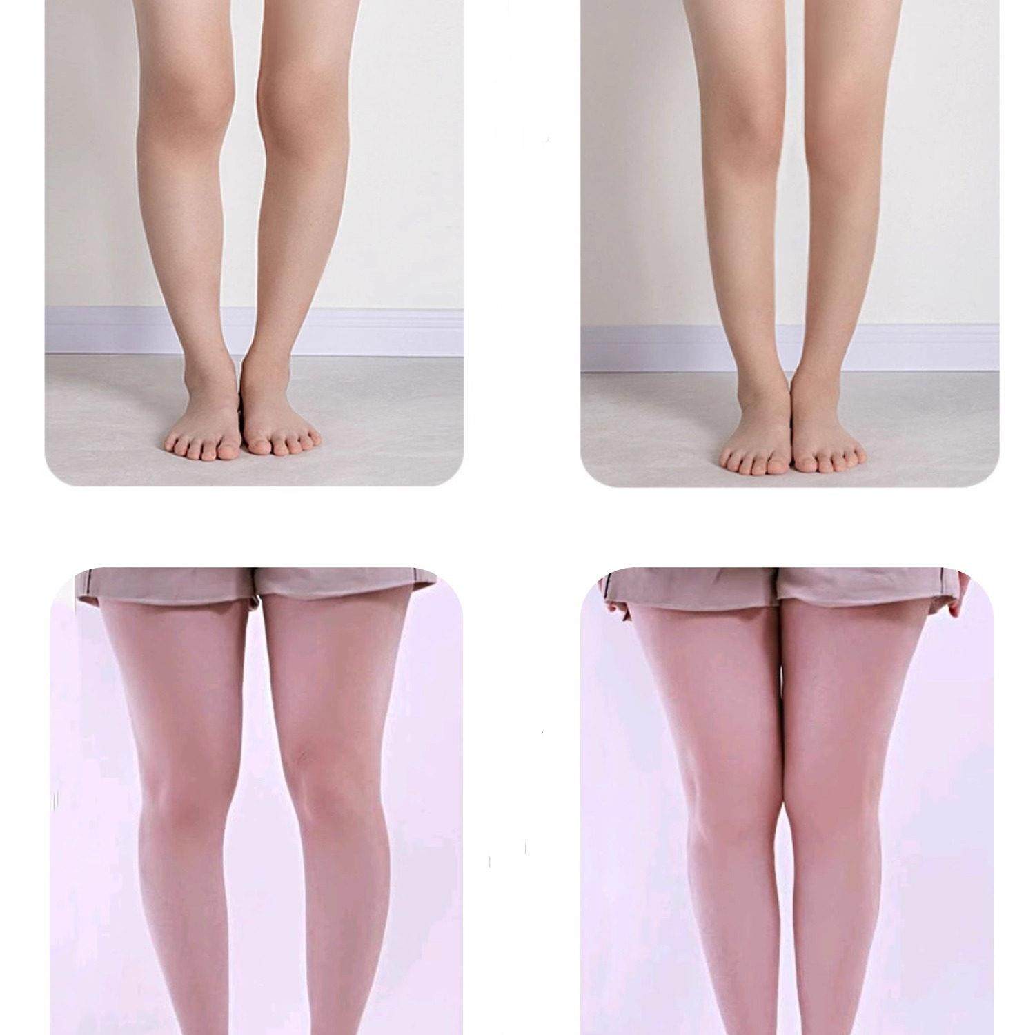 成人直腿神器o型X型小腿外翻矫正鞋垫扁平足弓支撑垫鞋防止鞋底磨