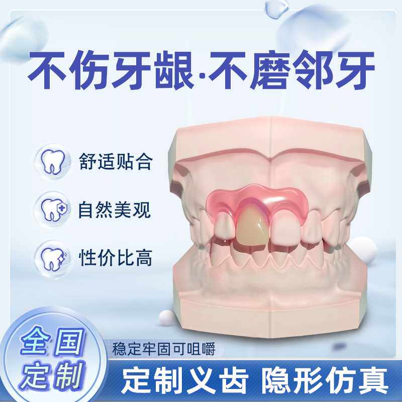 定制补缺牙活动假牙隐形义齿门牙遮丑神器种植临时假义牙套可吃饭