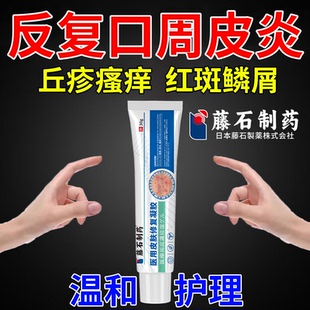 儿童舌舔口周唇炎皮炎嘴唇防干裂膏反复唇周过敏红斑丘疹瘙痒膏RW