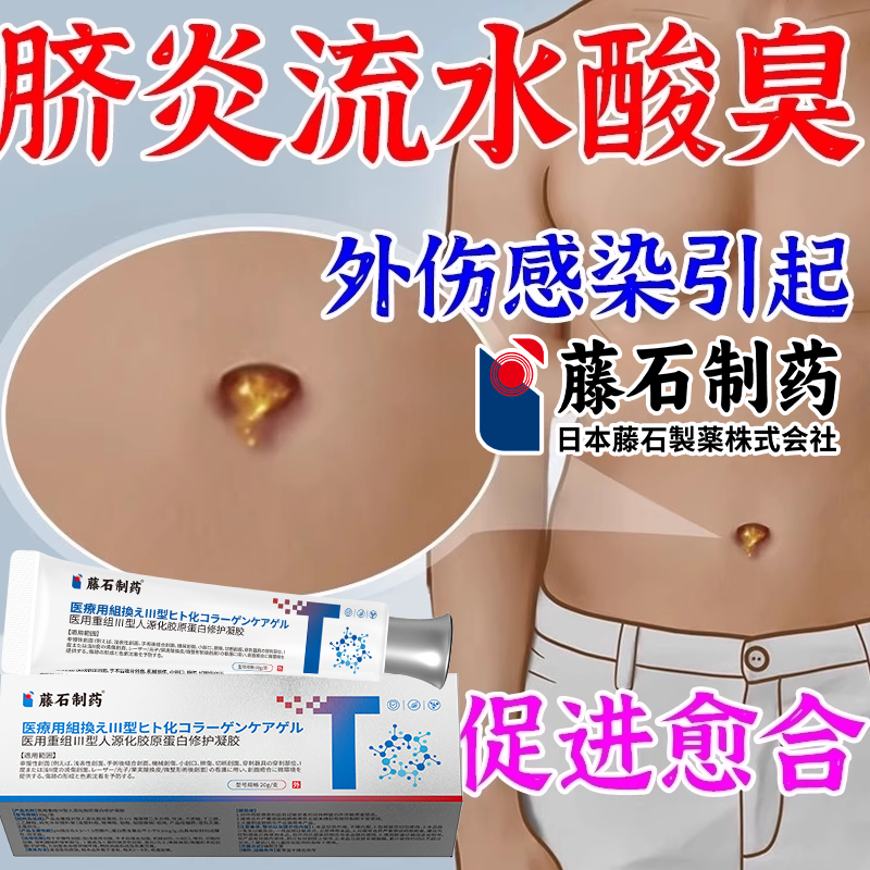 脐炎肚脐眼发炎流脓水痒发除臭红肿疼痛清洁去污垢消炎真菌感染RW