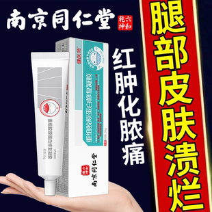 腿部皮肤溃烂皮肤红肿皮肤化脓痛皮肤痒皮肤溃疡出血脓液RW