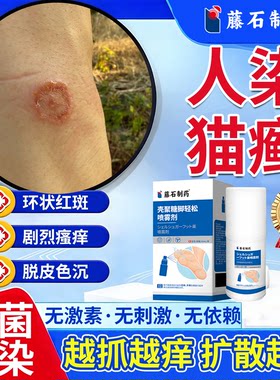 猫癣人用药房同售膏特环状红斑瘙痒效体癣真菌感染抑菌止痒消毒JI