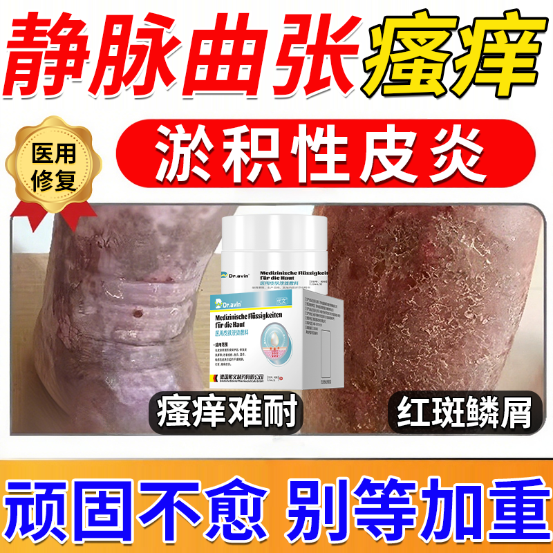 医用级冷敷凝胶药监认证